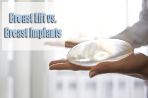 Breast Lift | Breast Implants | Dr. Rimma Finkel MD