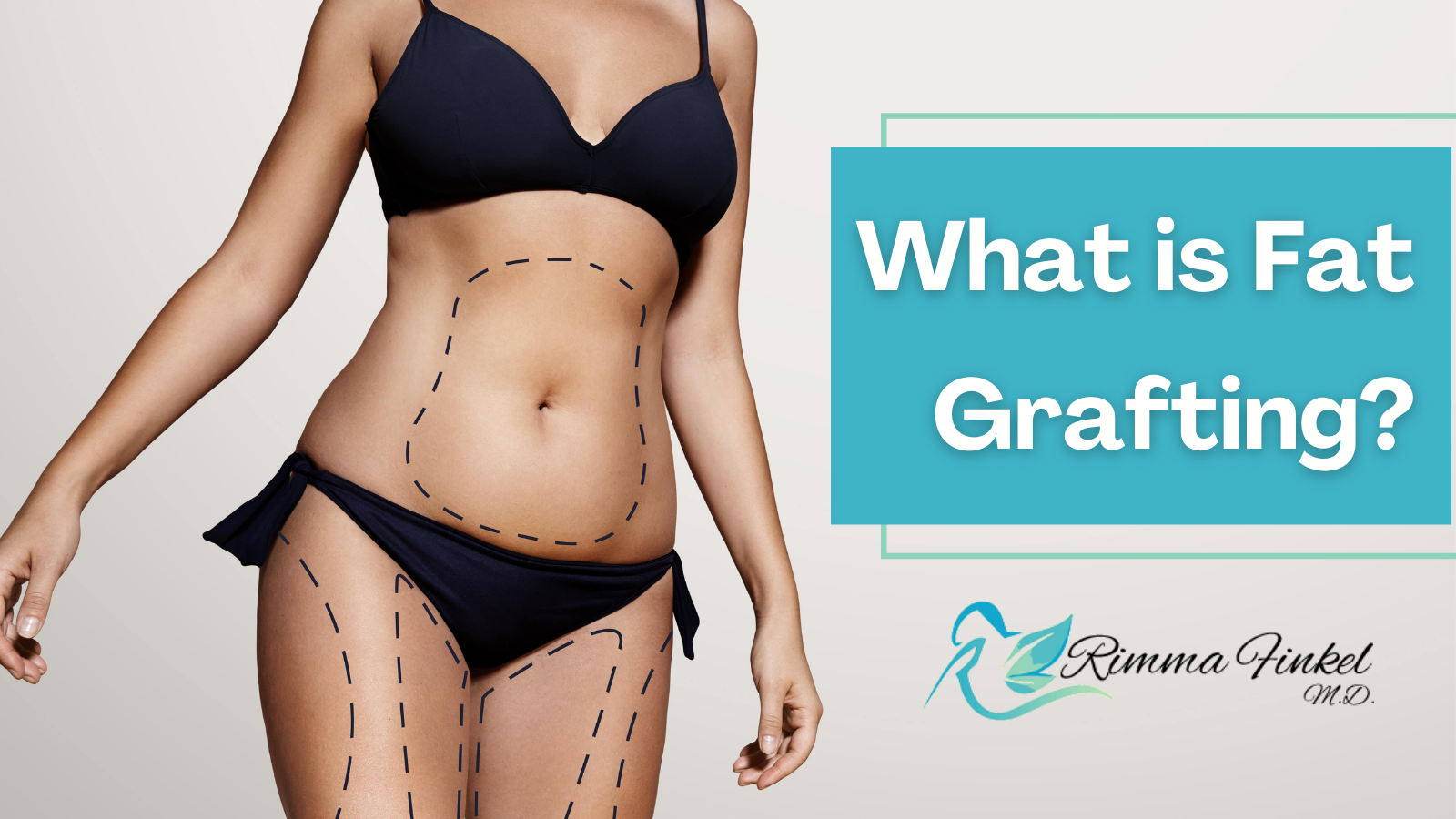 What is Fat Grafting?