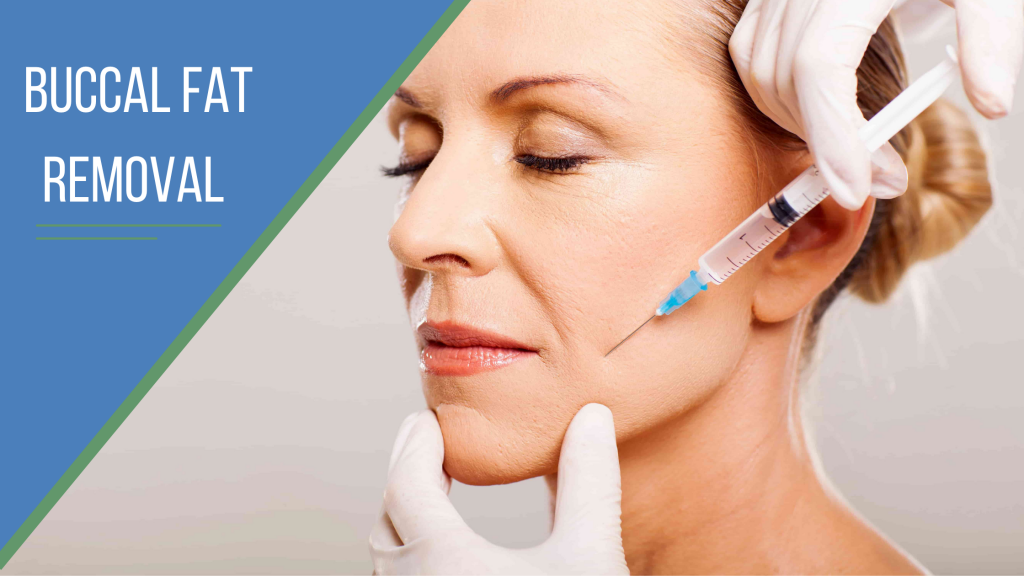 Buccal Fat Removal Dr Finkel MD Best Plastic Surgeon in Phoenix