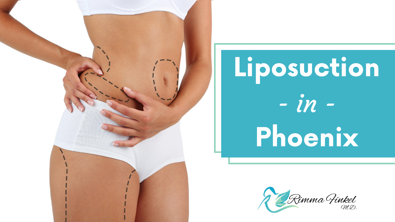 Liposuction in Phoenix