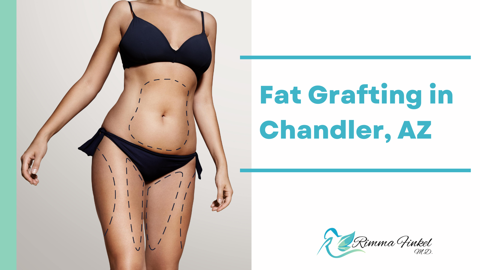 Fat Grafting in Chandler AZ